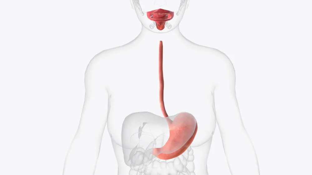 Cáncer de esófago en Guadalajara, Jalisco