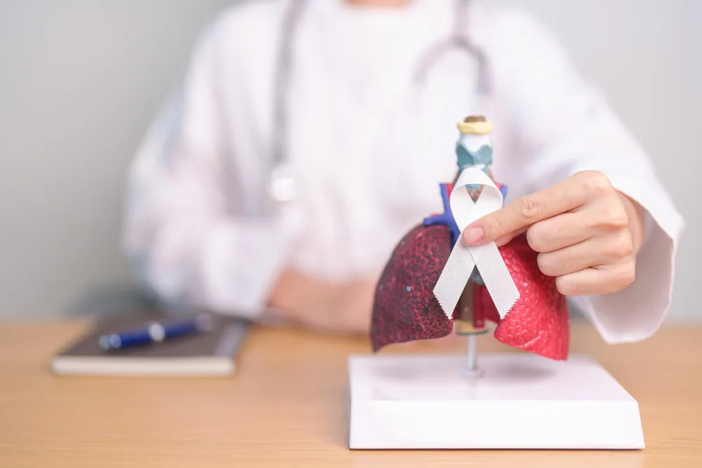 Cáncer de pulmón